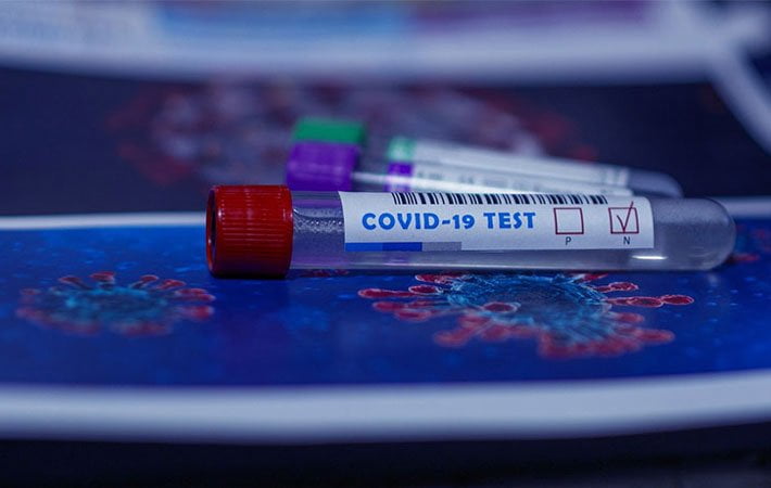 covid-19-tests-antigenique-pcr
